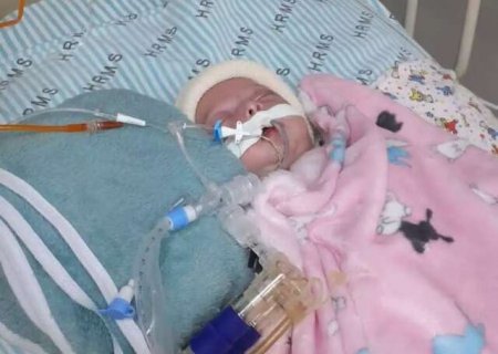 Menina com sequelas de entuba&ccedil;&atilde;o aguarda cirurgia h&aacute; quase 2 meses