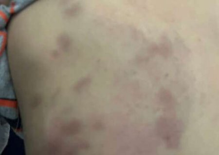 Mulher sai para trabalhar e filho de 3 anos &eacute; espancado pelo padrasto