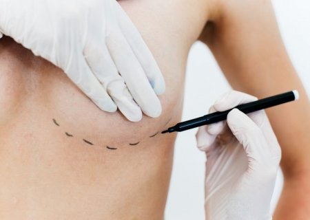 Nova lei amplia acesso a cirurgia reparadora de mama e apoio psicológico no SUS e em planos de saúde