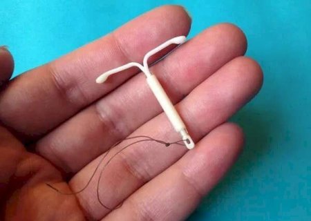 SUS amplia tratamento para mioma e sangramento intenso em mulheres